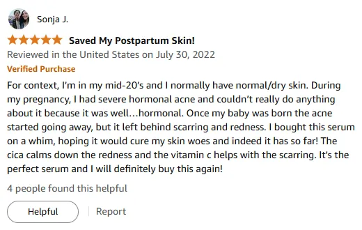 How Vitamin C Serum Faded My Pregnancy Acne Scars & Redness