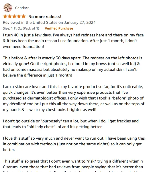 Redness Gone in 30 Days: Vitamin C Serum Review