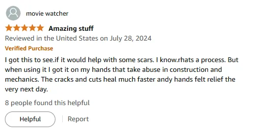 Vitamin E Oil Heals Scars & Cracked Hands Fast!