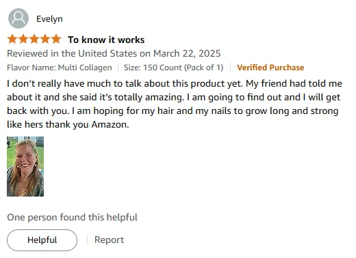 Vitamin A Transform: Friend's Hair & Nails Growth Secret